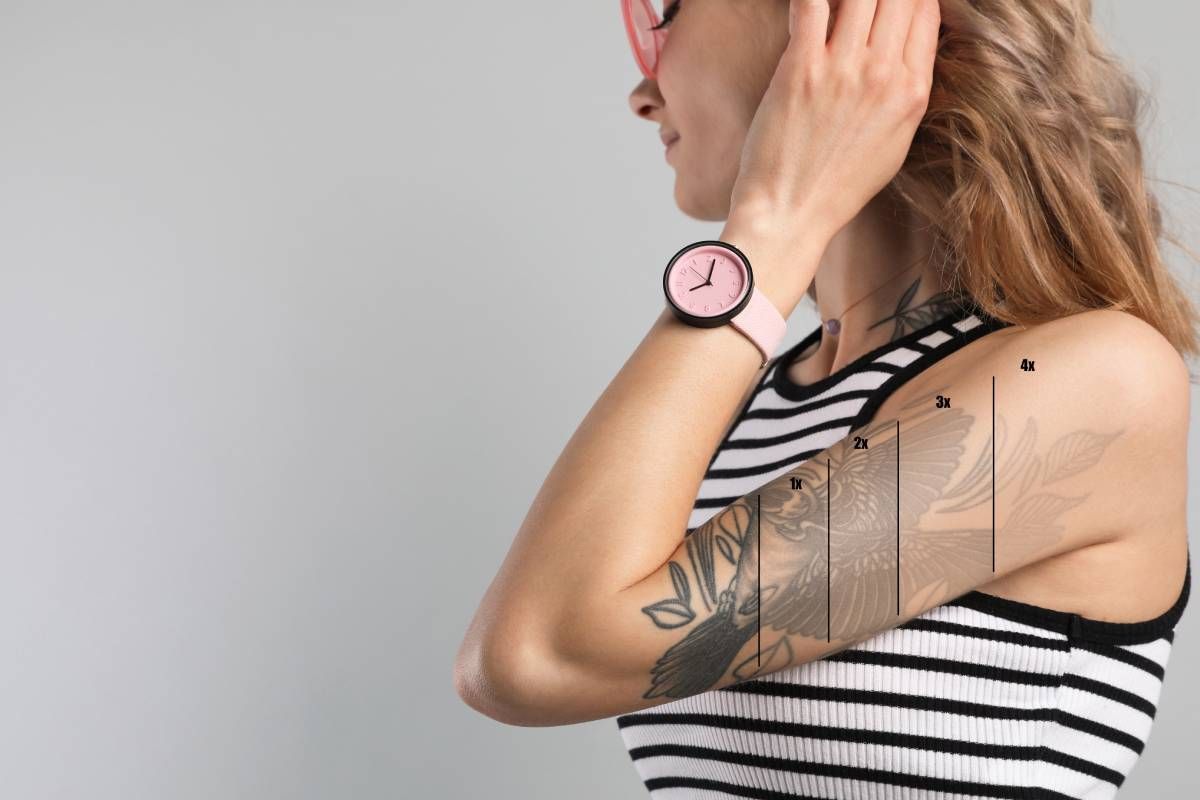 Concept of how laser tattoo removal works over time at Lexington Tattoo Removal near Lexington, KY