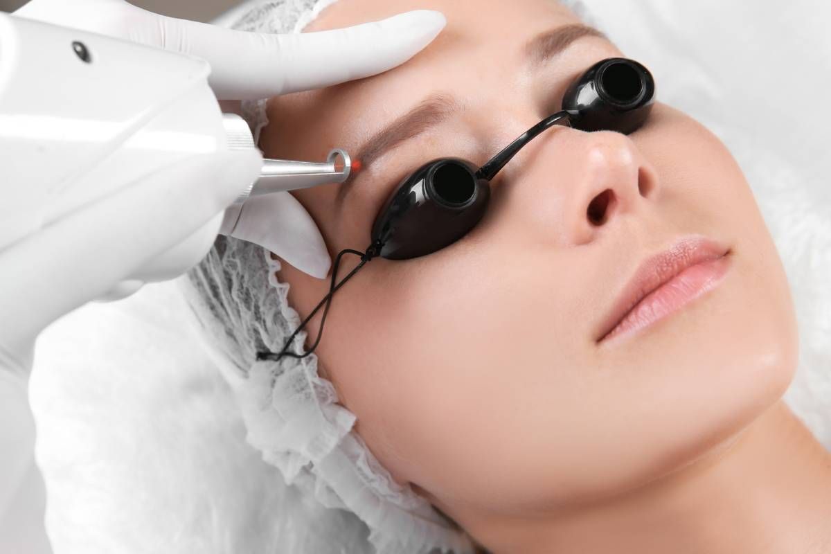 Someone receiving a microblading removal treatment during a session at Lexington Tattoo Removal near Lexington, KY