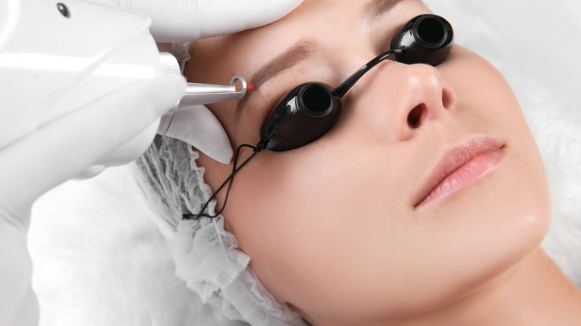 Someone receiving a microblading removal treatment during a session at Lexington Tattoo Removal near