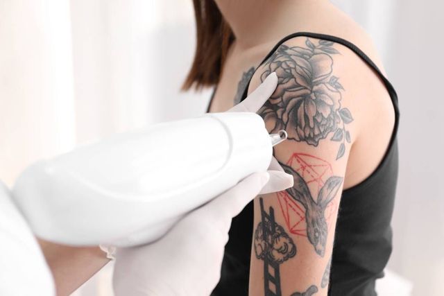 Tattoo Removal Training - Why You Should Get Certified in the Tattoo  Vanish® Method | Tattoo Removal School and Course | Best Tattoo Removal  Machine Cost | Tattoo Vanish Product
