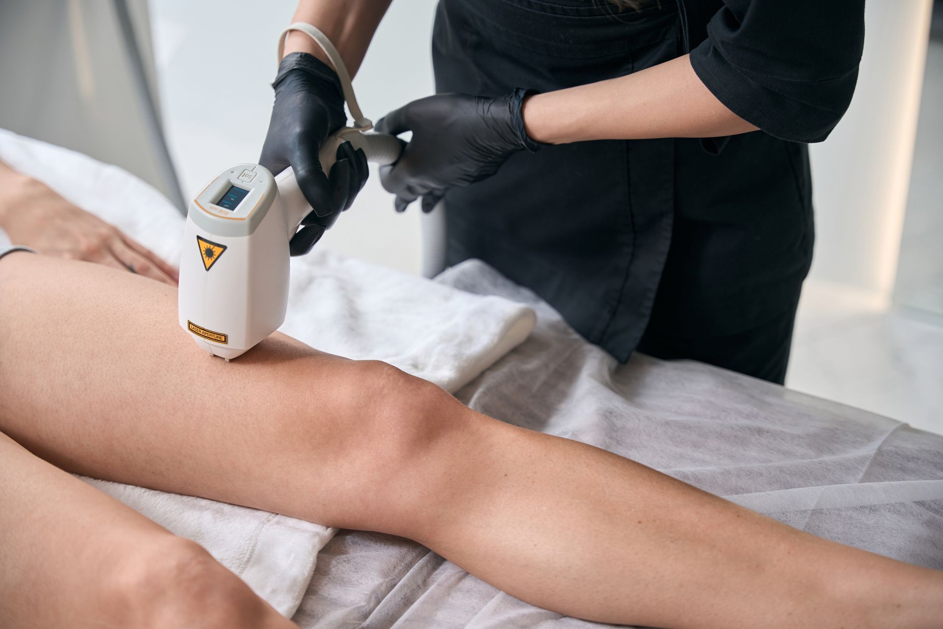 Laser hair removal treatment on the upper leg