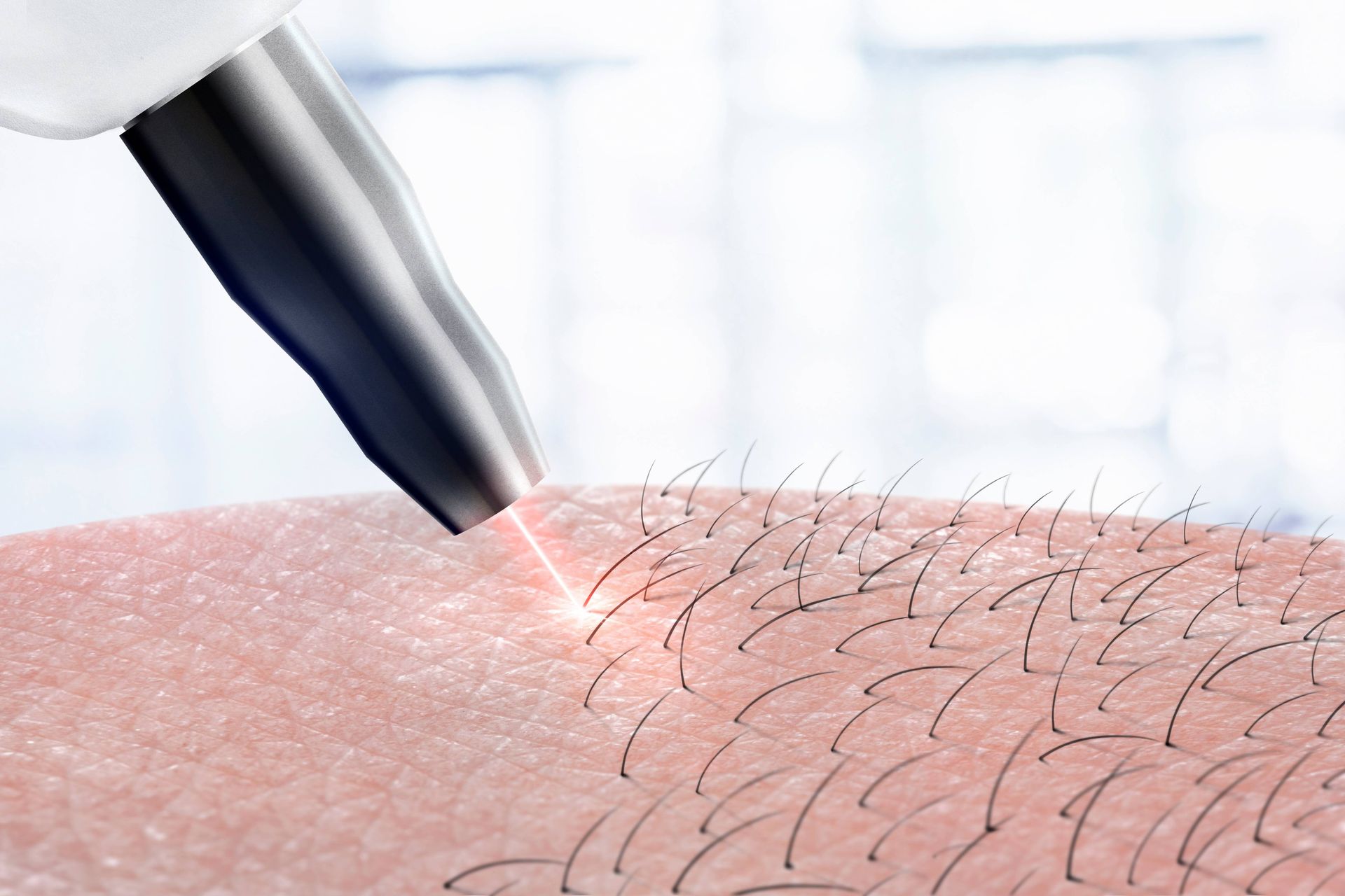 Concept art for laser hair removal near Lexington, KY