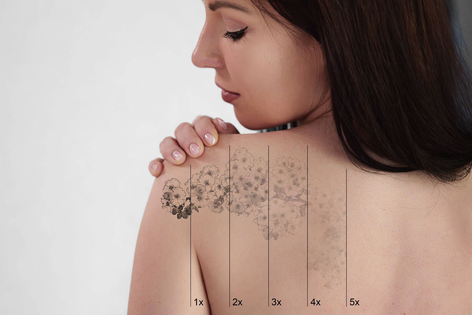 Concept of someone receiving laser tattoo removal treatments at Lexington Tattoo Removal near Lexing