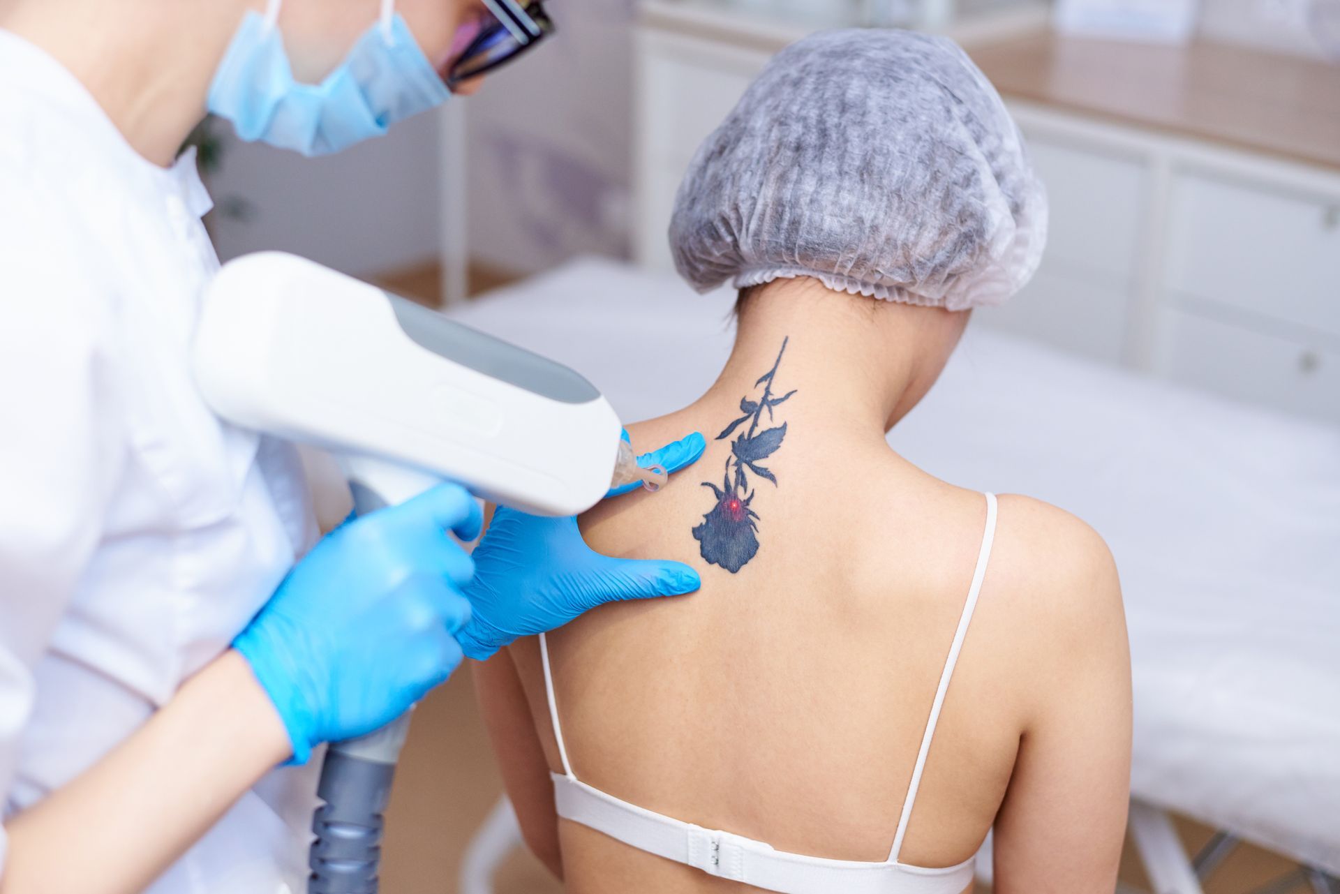 A woman is getting a tattoo removed from her back.