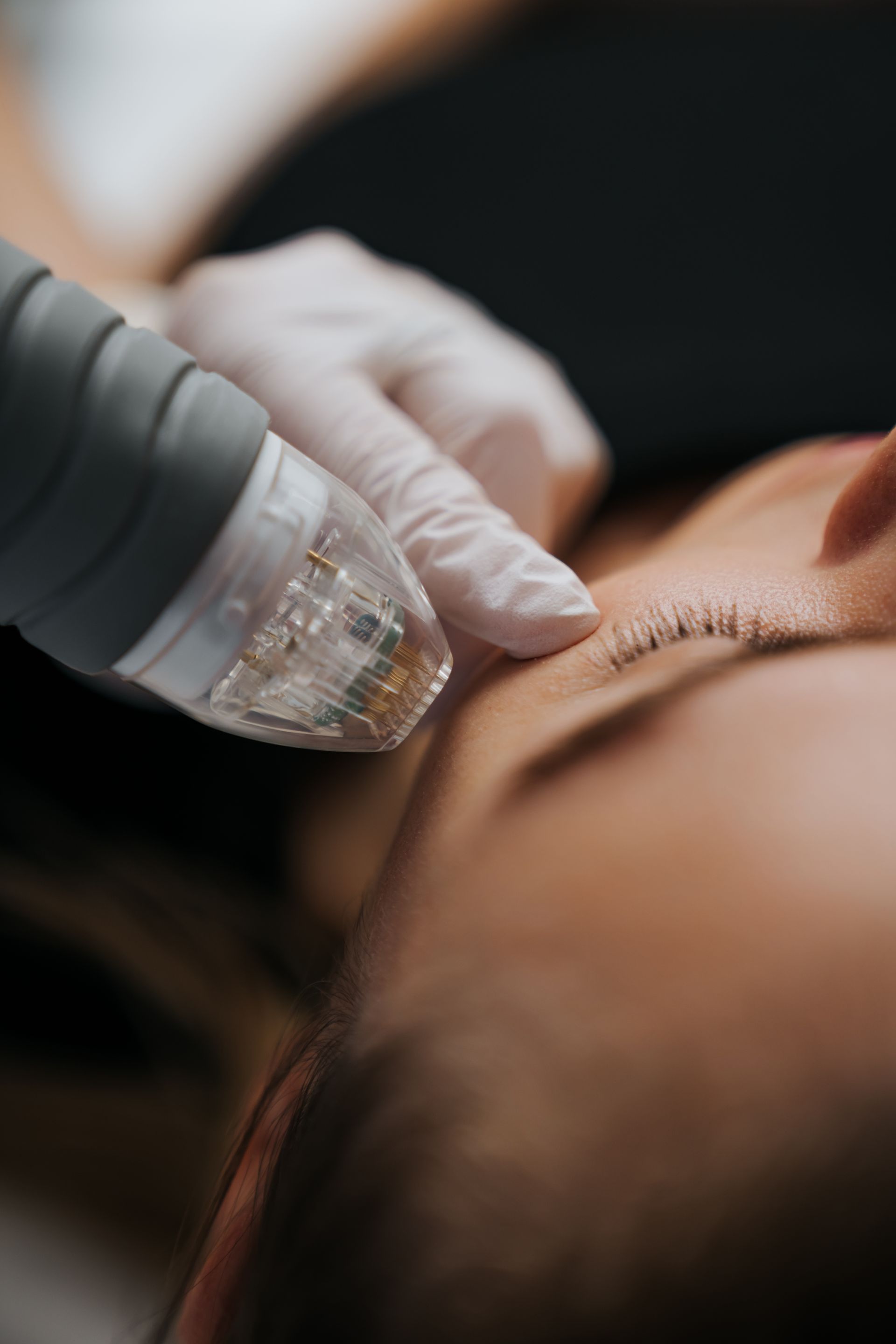 A woman is getting a laser treatment on her face.