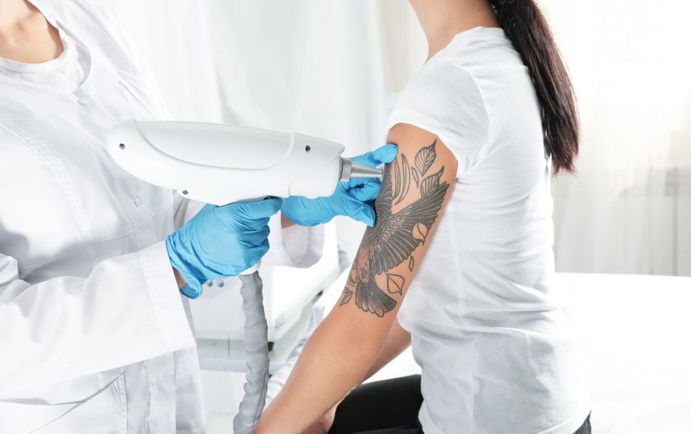 Person in Lab Coat Using Laser to Remove Tattoo on Patient's Arm — Aqua Marine Skin and Beauty in Forster, NSW