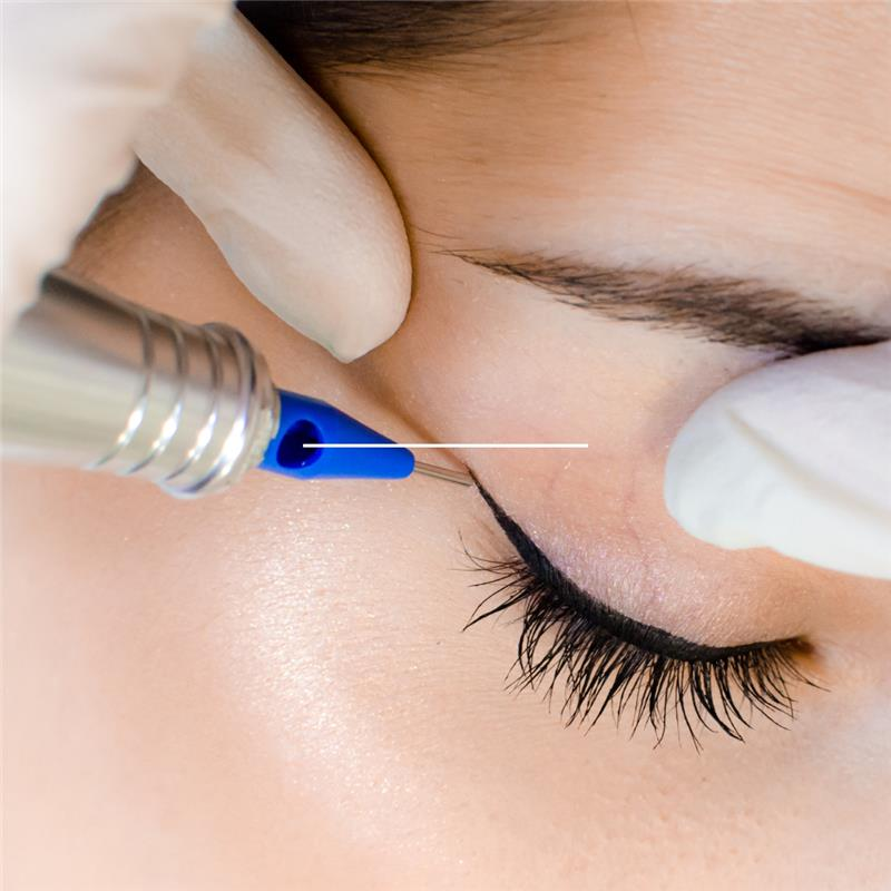 Eyeliner tattoo procedure: a gloved hand holds a tool applying pigment to a closed eye, creating a black line. — Aqua Marine Skin and Beauty in Tuncurry, NSW