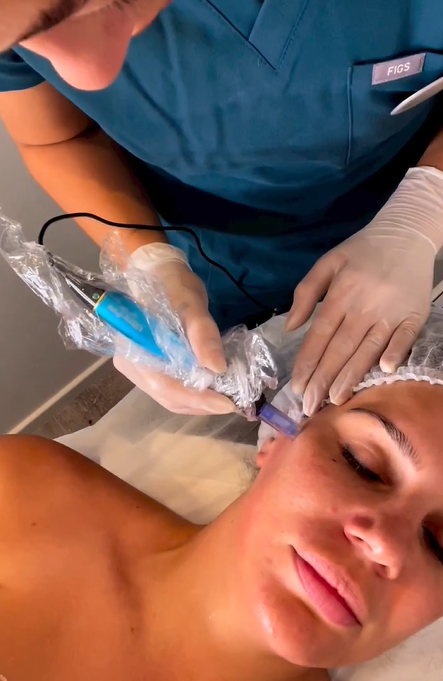 Person receiving cosmetic procedure on face; aesthetician with tool in gloved hand. — Aqua Marine Skin and Beauty in Tuncurry, NSW