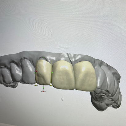 Dentist Examining a Patient Teeth — Launceston, TAS — Everything Dental