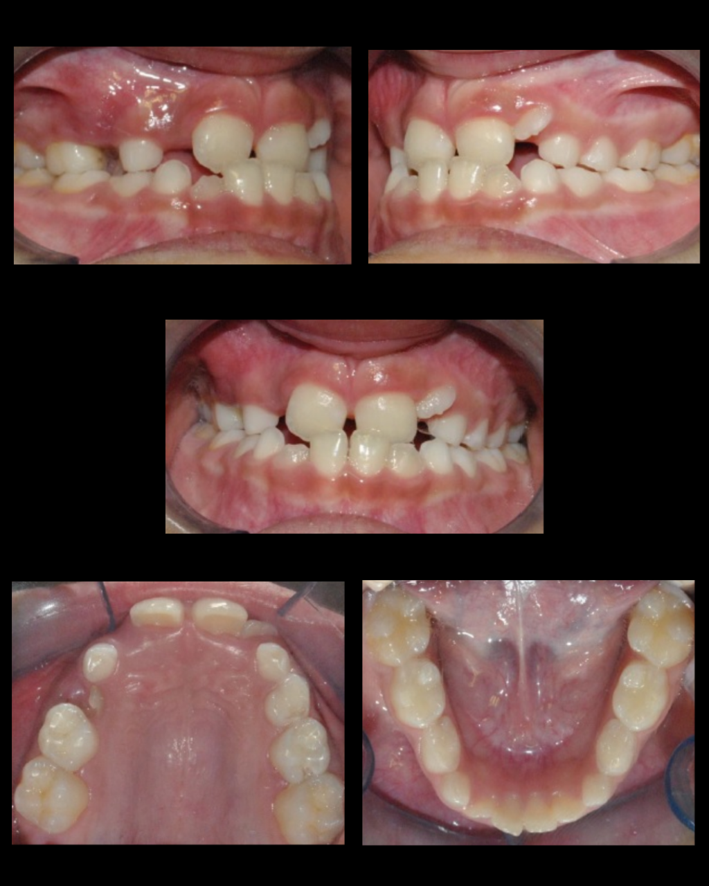 FOTOGRAFÍAS INTRAORALES