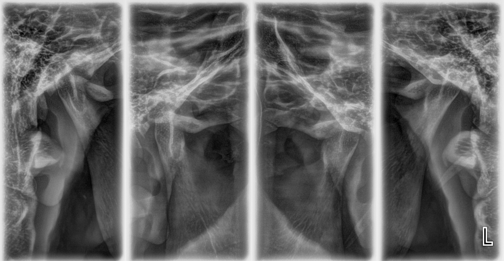 ESCANOGRAFÍA DE ATM