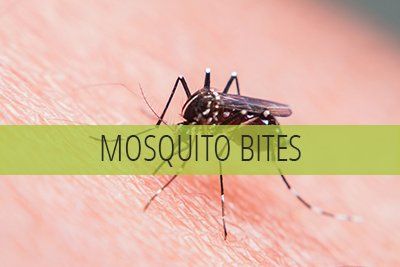 Mosquito and insect bites