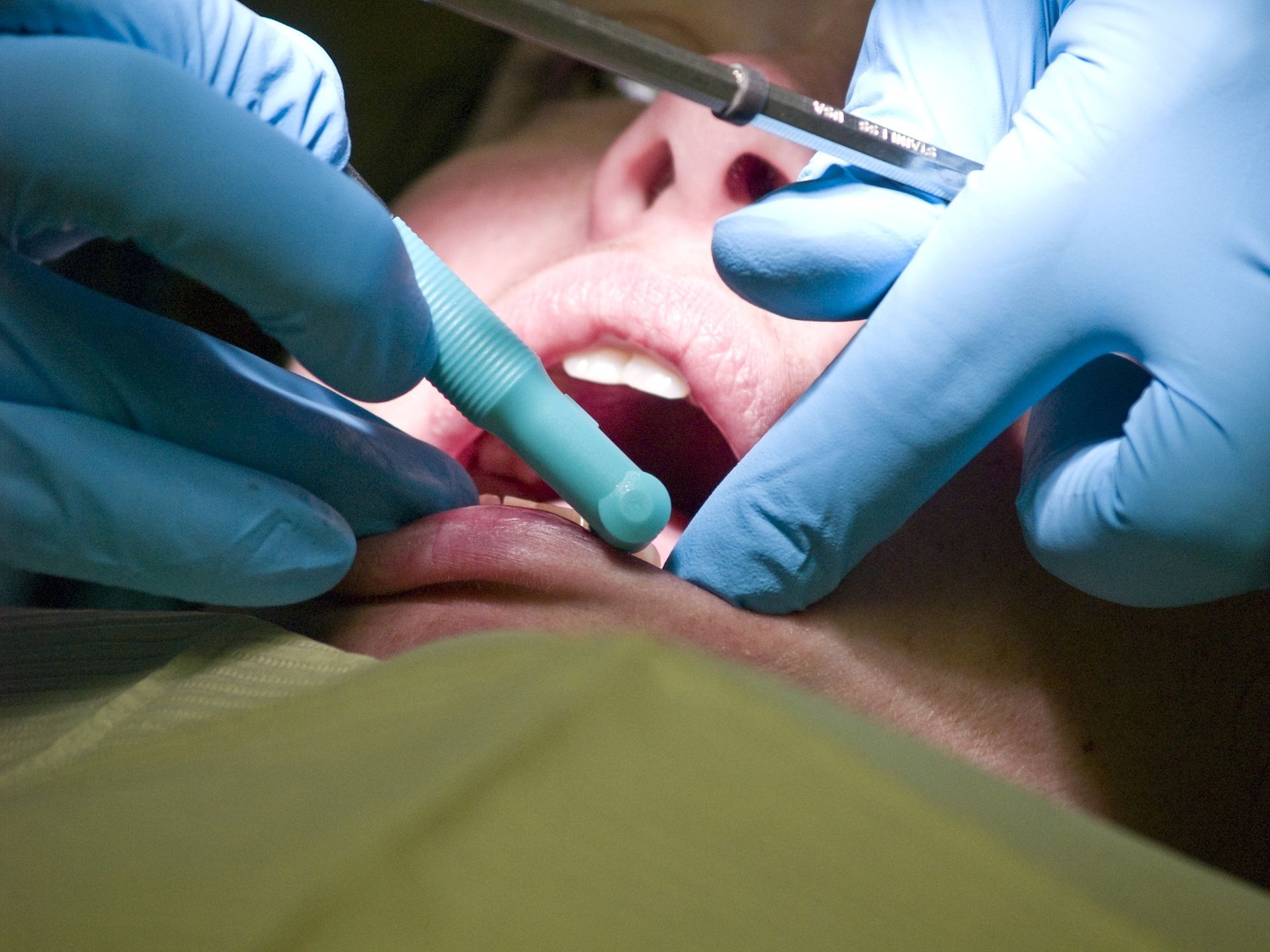 emergency dental procedure