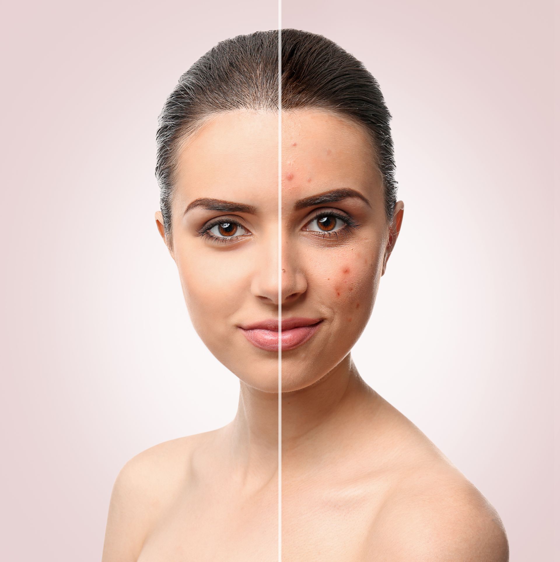 A side-by-side comparison of a face showing smooth skin on the left and visible signs of aging like wrinkles on the right.