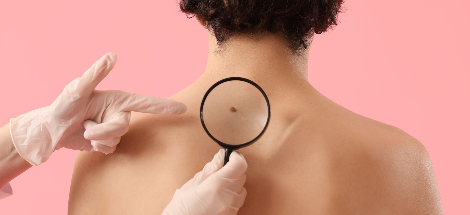 A person wearing gloves examines a spot on someone's upper back with a magnifying glass against a pink background.