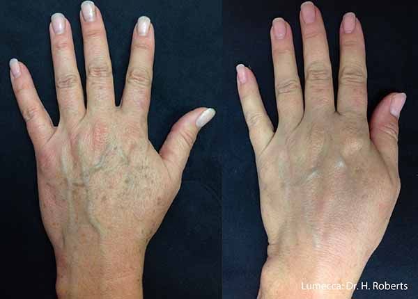 A before and after photo of a woman 's hands