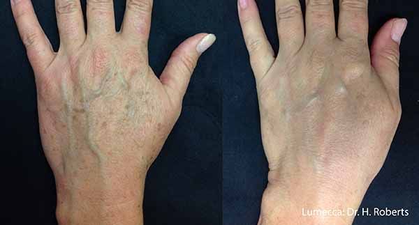 A before and after photo of a woman 's hands