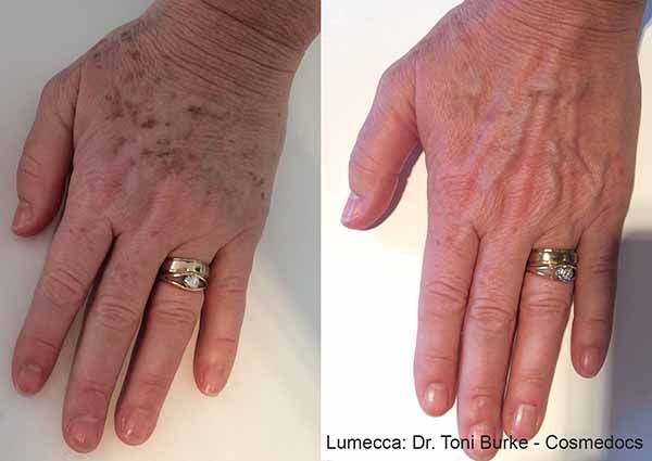 A before and after photo of a woman 's hands