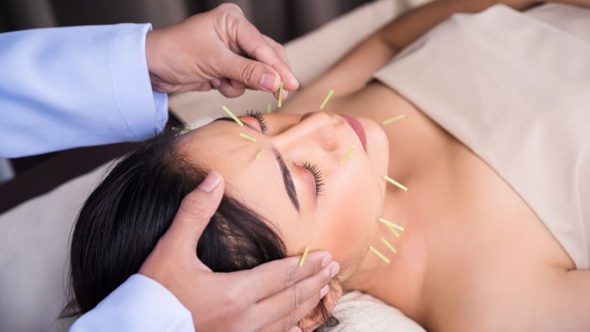 Patients receives acupuncture treatment for TMJ Pain