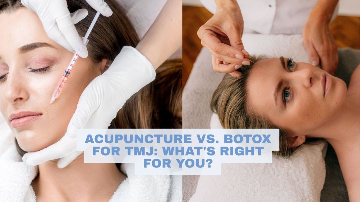 Acupuncture vs. Botox patients split image 