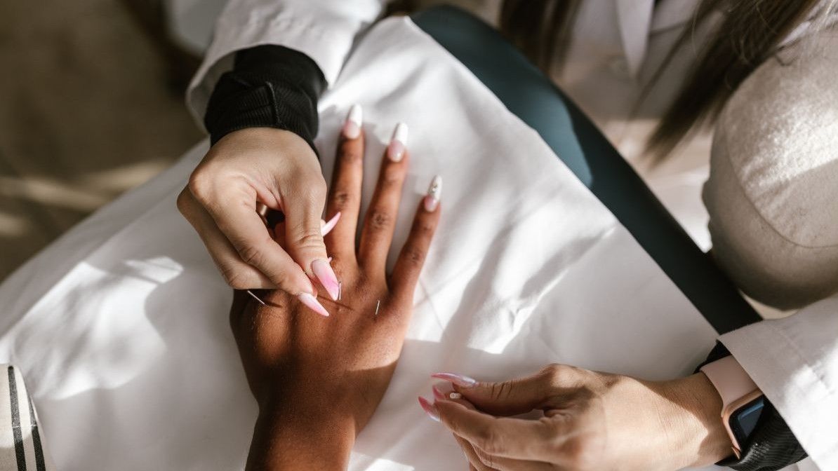 Acupuncture performed for a patient expecting a dental surgery