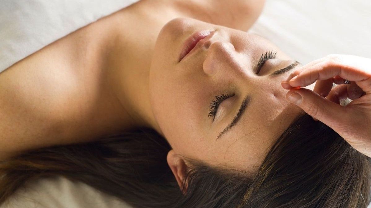 A patient receives Acupuncture After Dental Implants & Surgery