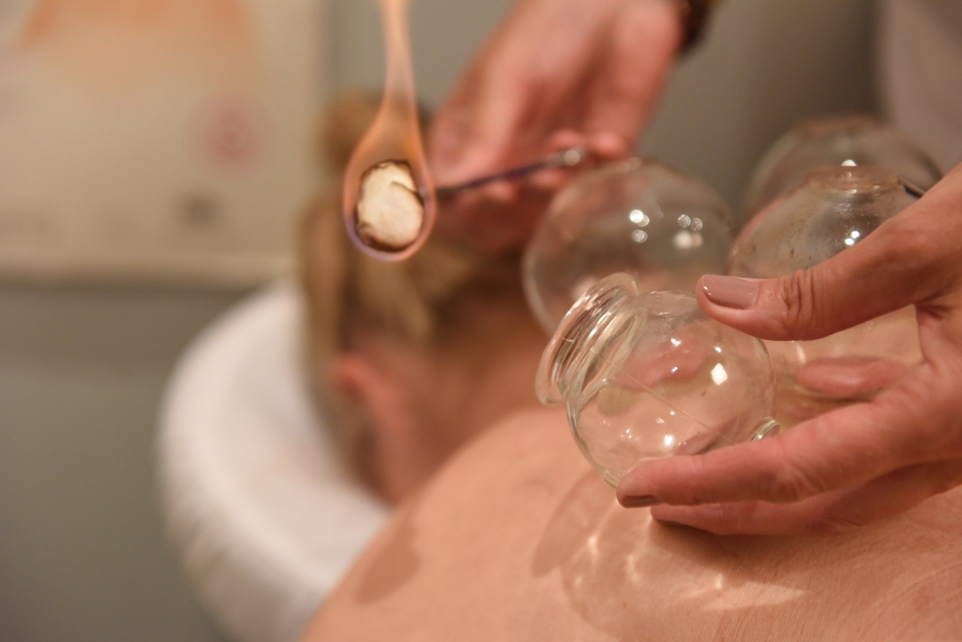 Full-Mouth Reconstruction