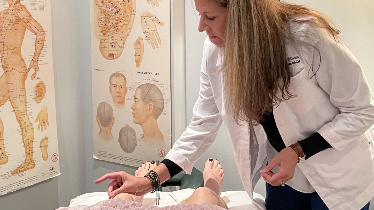 Dr. Danielle Solomon (L.Ac) performs acupuncture on a patient at Tribeca Smiles