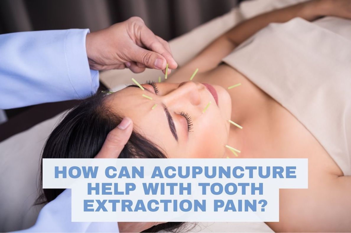 A patient receives acupuncutre treatment for tooth extraction pain relief