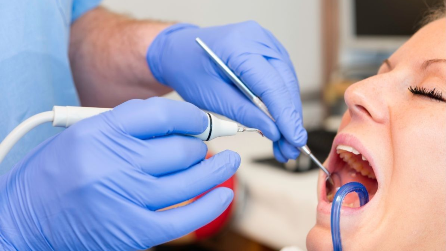 In office hygiene dental cleaning teeth