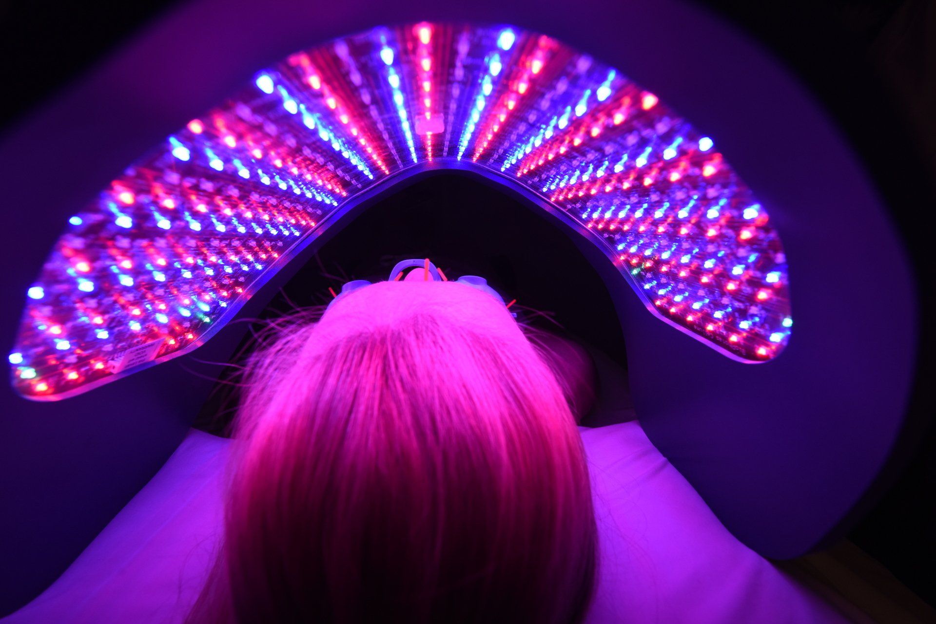 Acupuncture Service on Patient