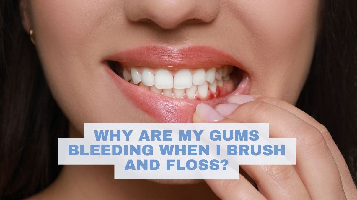hand pulls down lips on a face to reveal gum bleeding 
