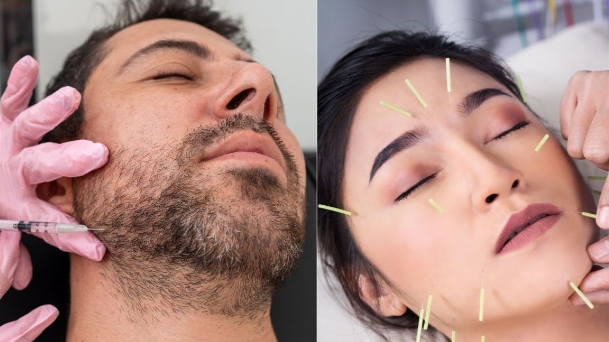 Acupuncture vs. Botox for TMJ pain, split image