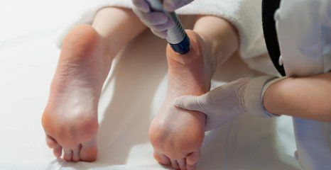 cracked heel treatment