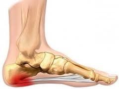 foot after treatment