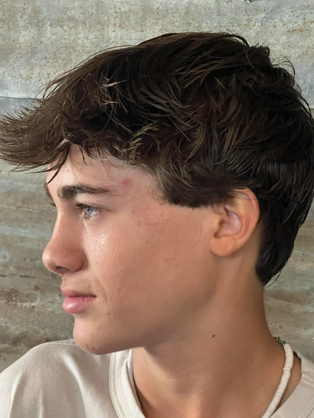 A close up of a young man 's face with a white shirt on