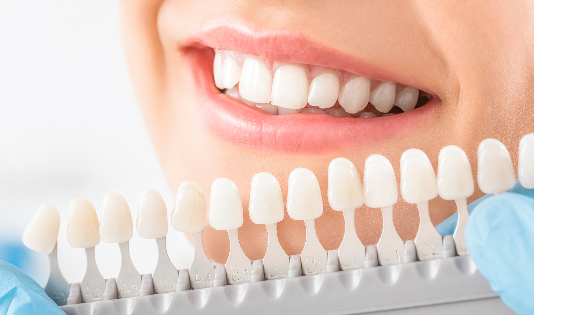 A woman is holding a tooth color chart in front of her teeth.