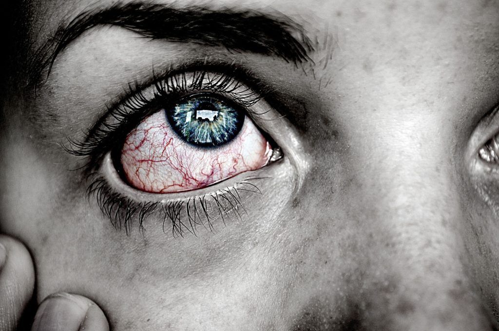 How To Tell If You Have An Eye Infection