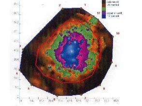 picus ultrasound