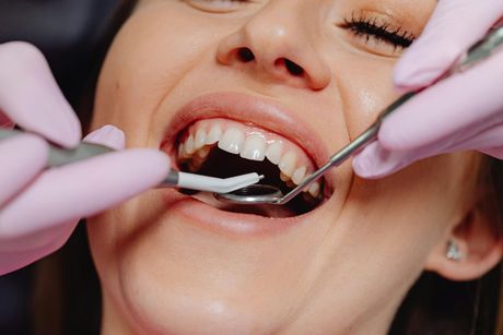 Dentist examining a smiling patient’s open mouth with dental tools and pink gloves