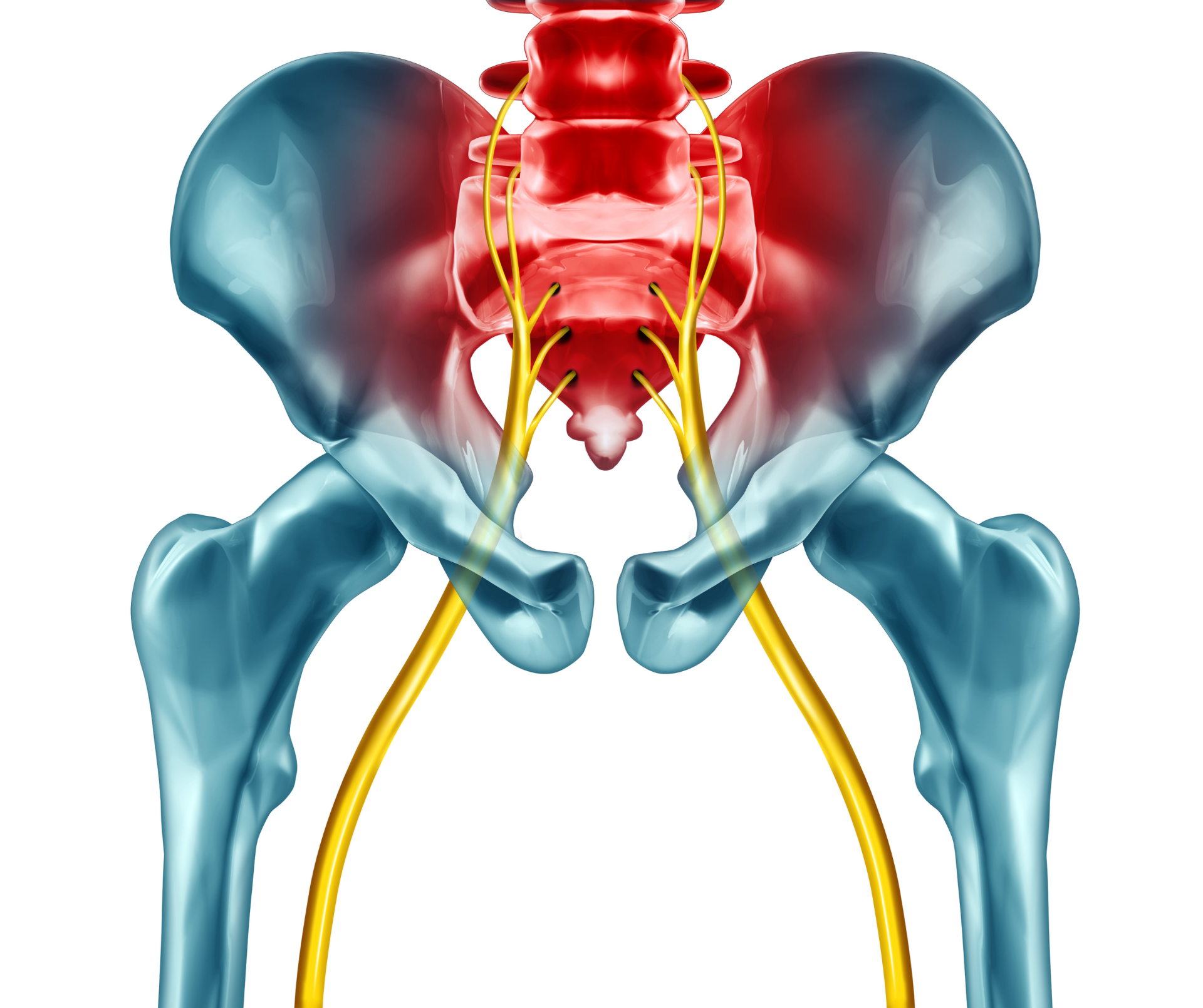 sciatica-lumbar-disc-back-pain-treatment-the-pain-relief-practice