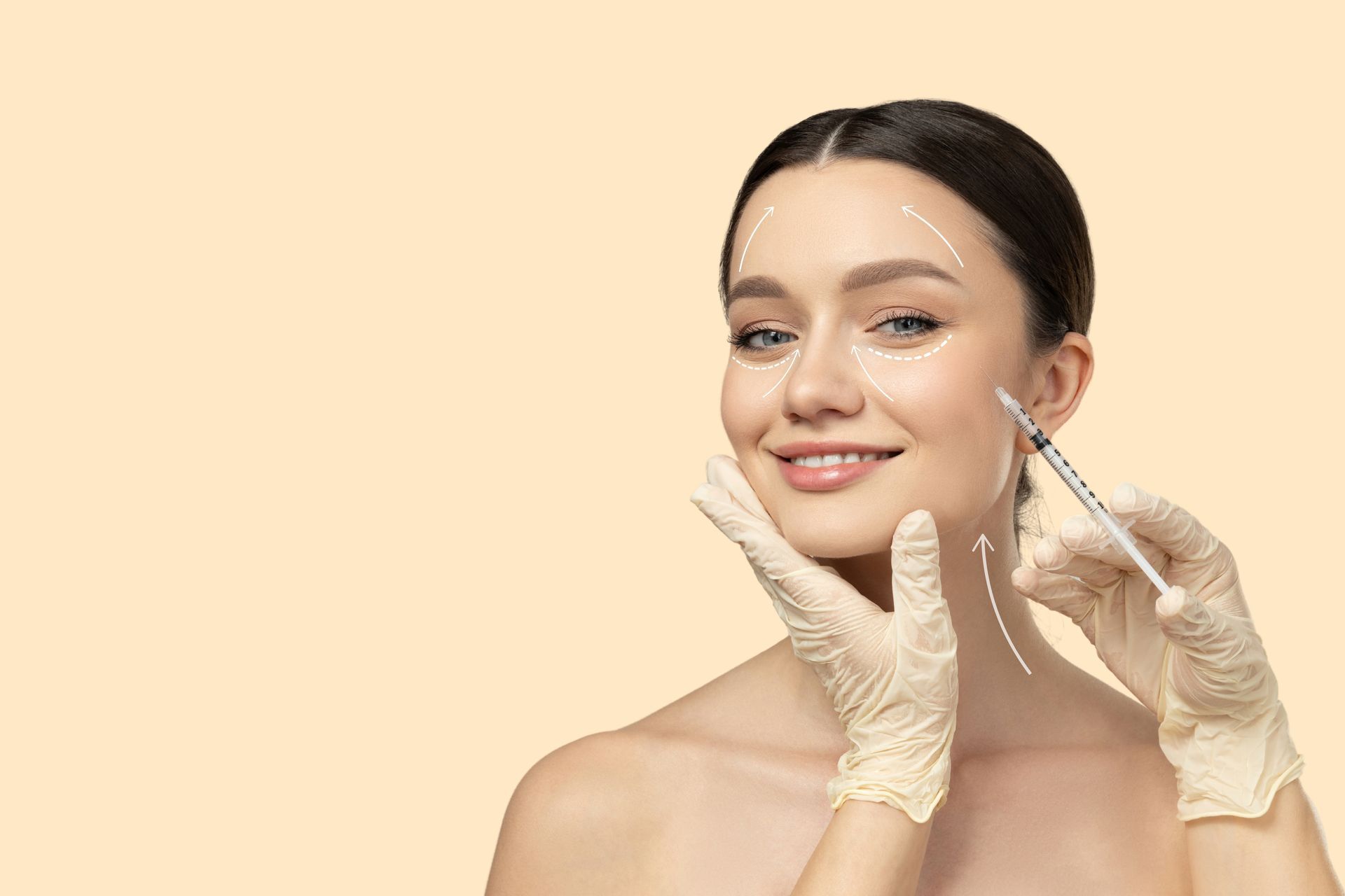 Woman receiving facial injections, wearing gloves, with lines drawn on her face.