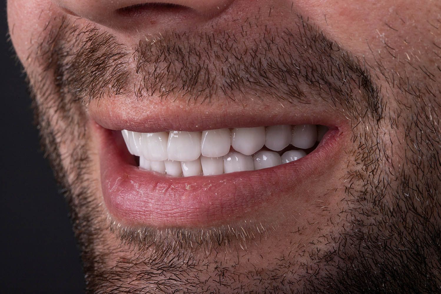 Aesthetic Dental Restoration