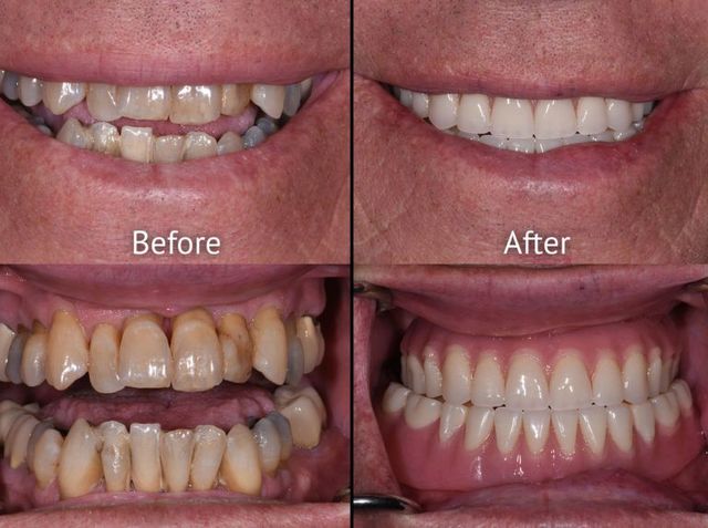 Revitalize Your Smile with Expert Restorative Dentistry at Spring ...