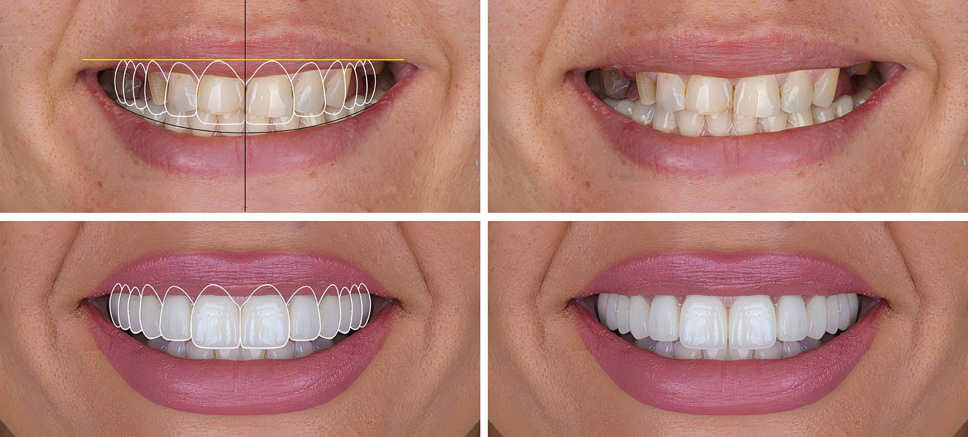 Top Cosmetic Dentistry Innovations