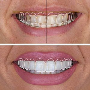 2025 Cosmetic Dentistry Trends in the US