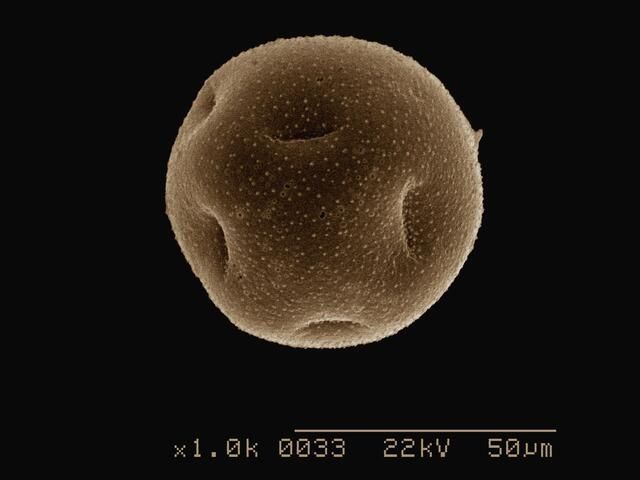 a close up of a sphere under a microscope at 22kv