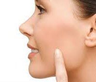 Cirugia de Cachetes Guadalajara