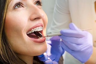 Woman with Braces Dental Check-up — Rancho Cucamonga, CA — Accent on Dentistry