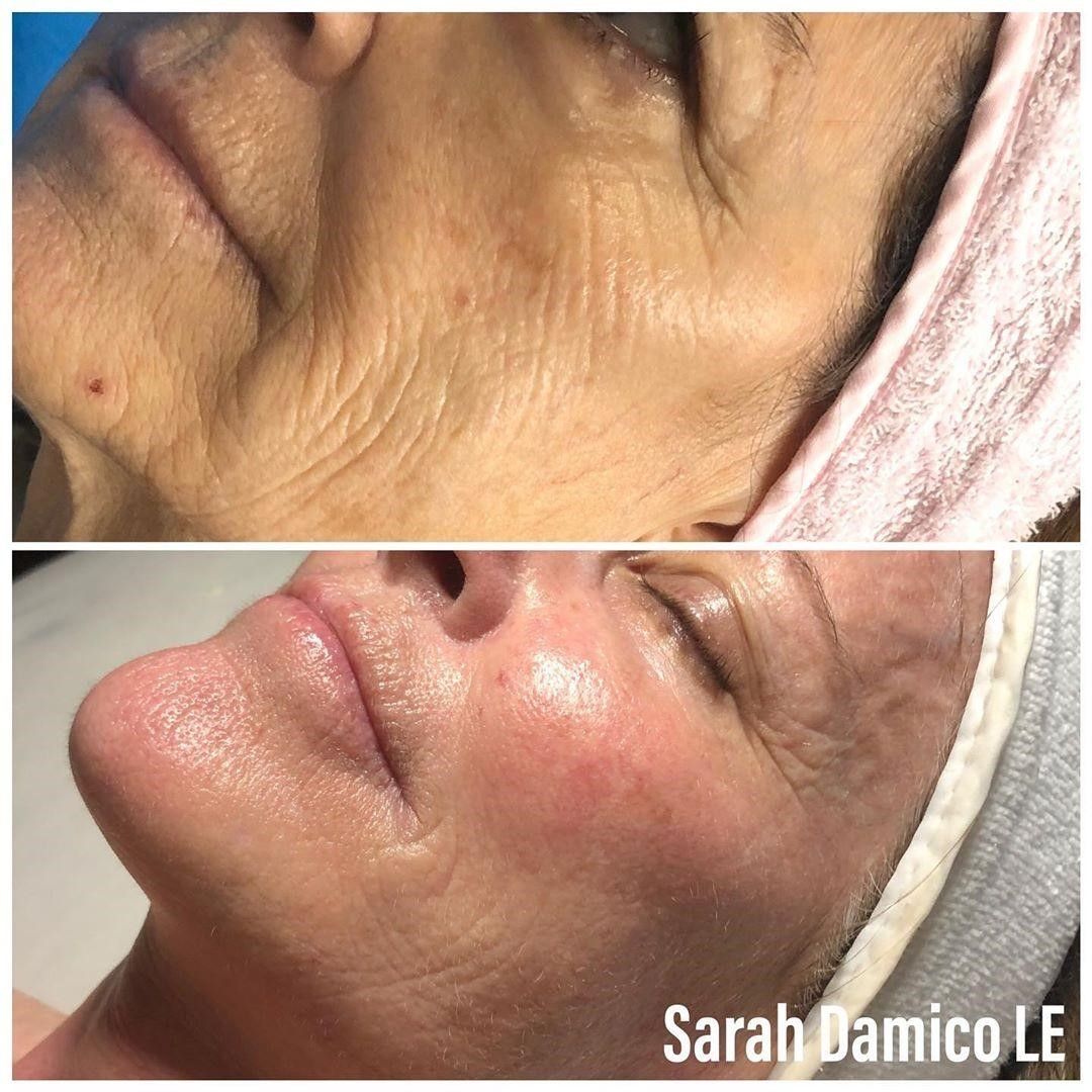 A before and after photo of a woman 's face